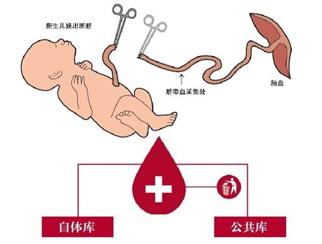 為什么國家不普及儲存臍帶血