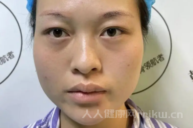 磨骨手術失敗會怎么樣