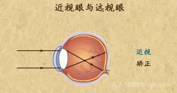 眼視光醫(yī)學(xué)和眼視光學(xué)的區(qū)別