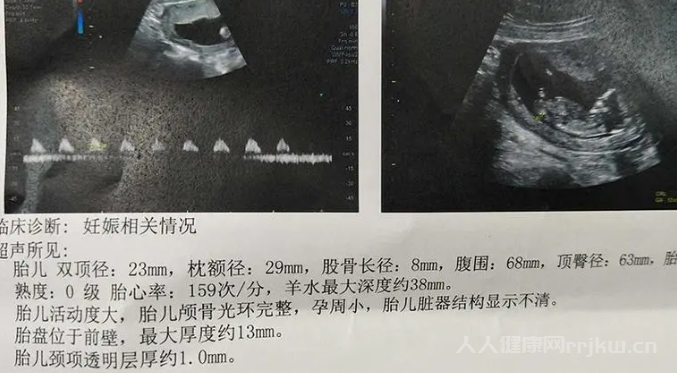 nt值看男女85%的準確率!