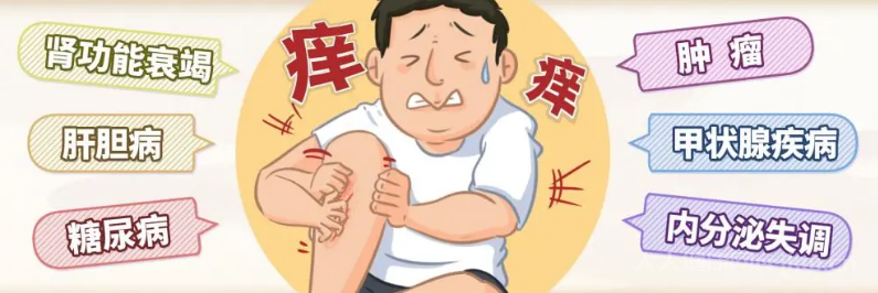 濕疹止癢妙招,濕疹正確解決方法