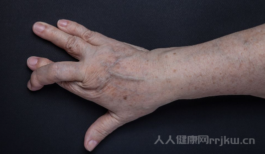 皮膚白斑什么原因引起的