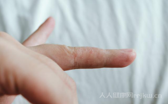 手指頭上起透明小水泡很癢怎么辦