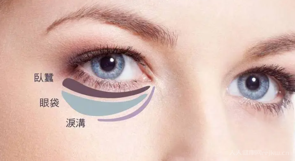 如何去眼袋教你十種最有效的方法
