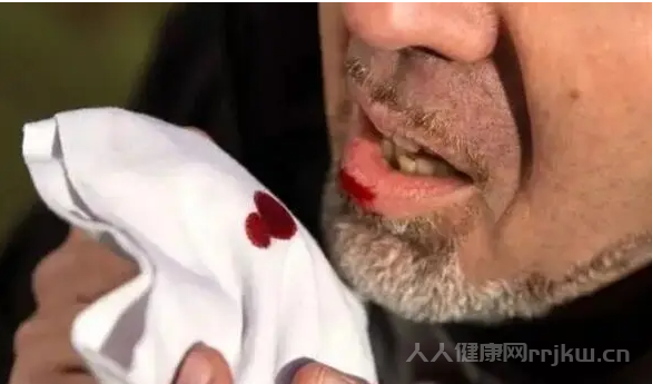 肺癌晚期死前征兆癥狀有哪些