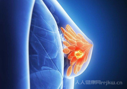 乳腺癌晚期怎么治療
