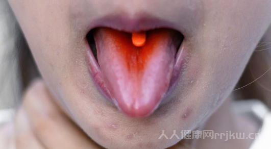 舌苔發黃是什么原因