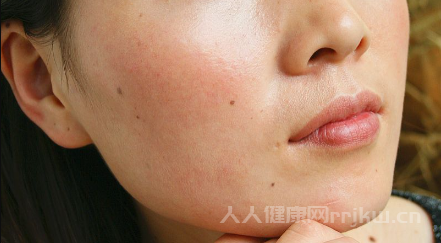 過敏性體質怎么改善