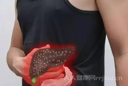 肝癌的早期癥狀七個典型癥狀不可忽視