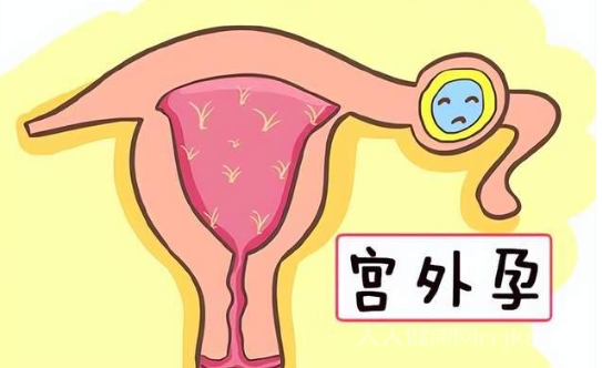 宮外孕hcg值的范圍