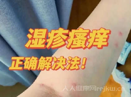 濕疹最佳治療方法