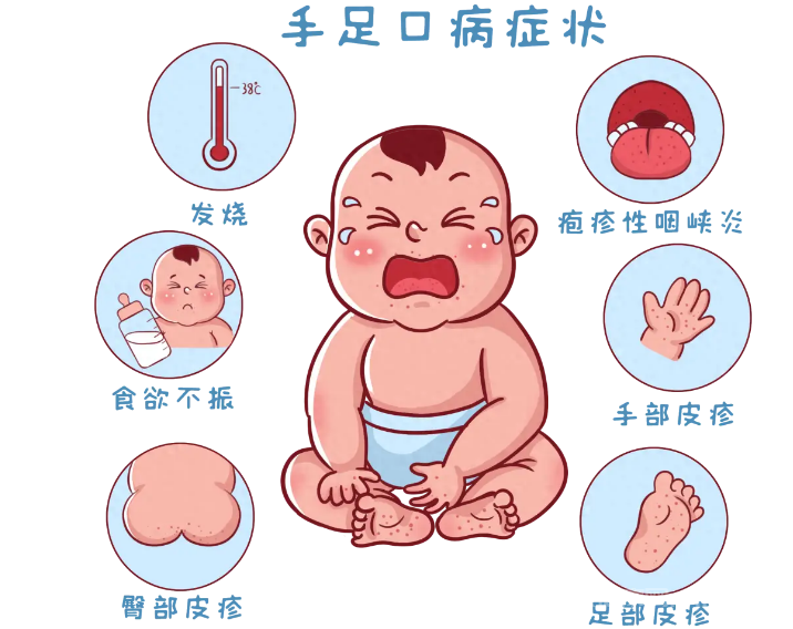 手足口病會傳染大人么圖2
