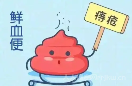 痔瘡怎么引起的圖3