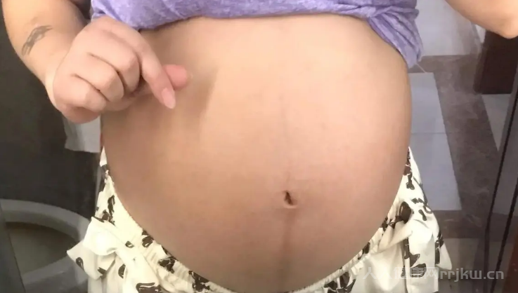 孕婦肚子上長毛如何判斷是男是女