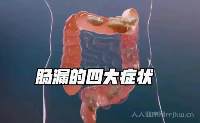 腸漏有什么癥狀