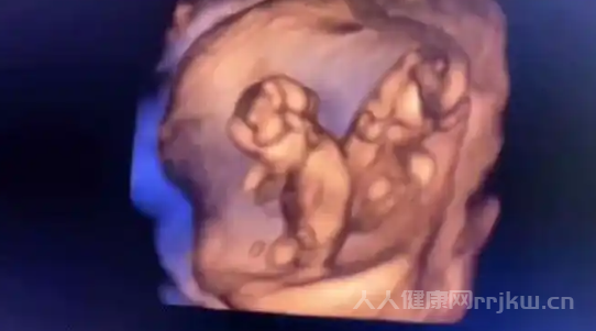 陪孕婦做四維產檢怎么看是男孩還是女孩