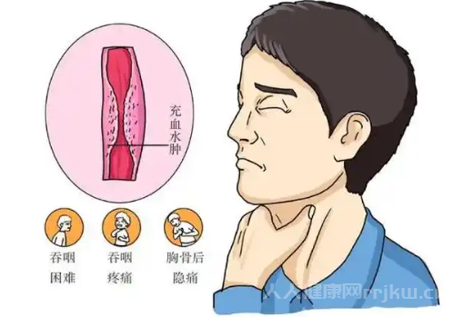 食道癌是什么原因導致的
