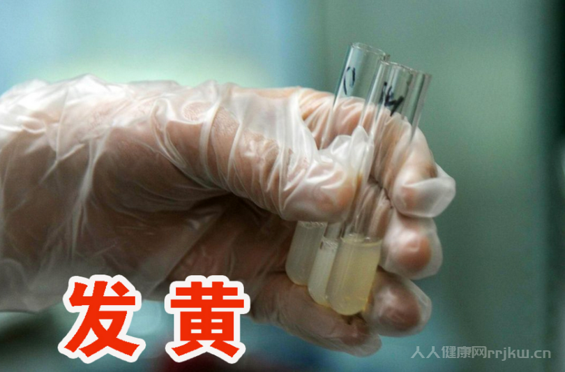 男生去醫院檢查生精質量需要禁欲幾天
