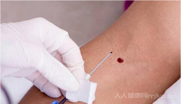 甲功五項報告單怎么看正不正常
