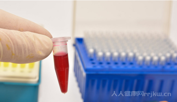 最常見的血型是什么血型類型