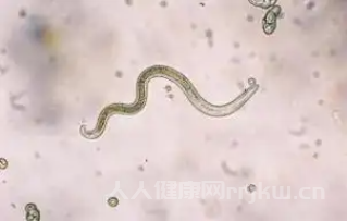 弓形蟲病的癥狀