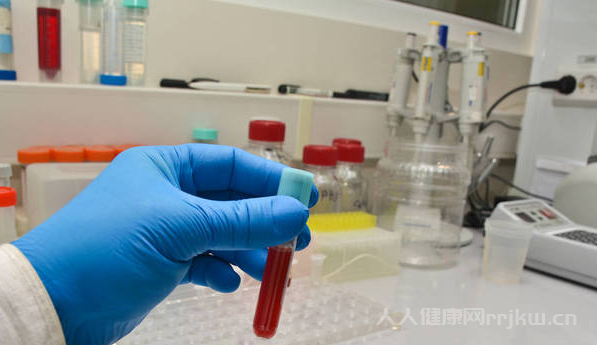 性激素六項(xiàng)檢查什么時(shí)候查合適月經(jīng)第幾天圖1
