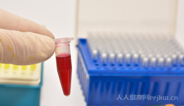 性激素六項(xiàng)檢查什么時(shí)候查合適月經(jīng)第幾天圖2