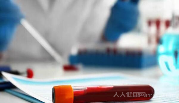 鐵蛋白高有什么癥狀和危害有哪些圖2