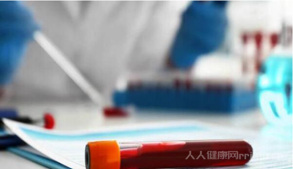 鐵蛋白高不能吃的食物有哪些